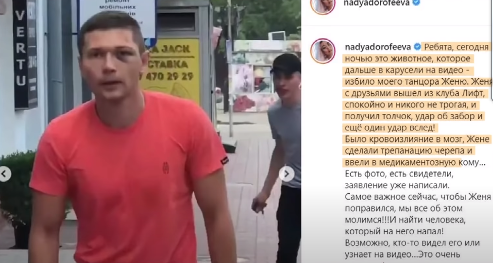 Що відомо про стан танцюриста Наді Дорофеєвої, якого побили Фото 1